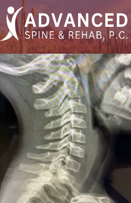 Learn how to recognize and treat tension headaches—key symptoms, causes, red flags, and proven therapies—plus individualized, compassionate care at Advanced Spine & Rehab in Mesa, AZ.